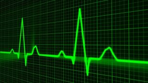 pulse trace, healthcare medicine, heartbeat-163708.jpg
